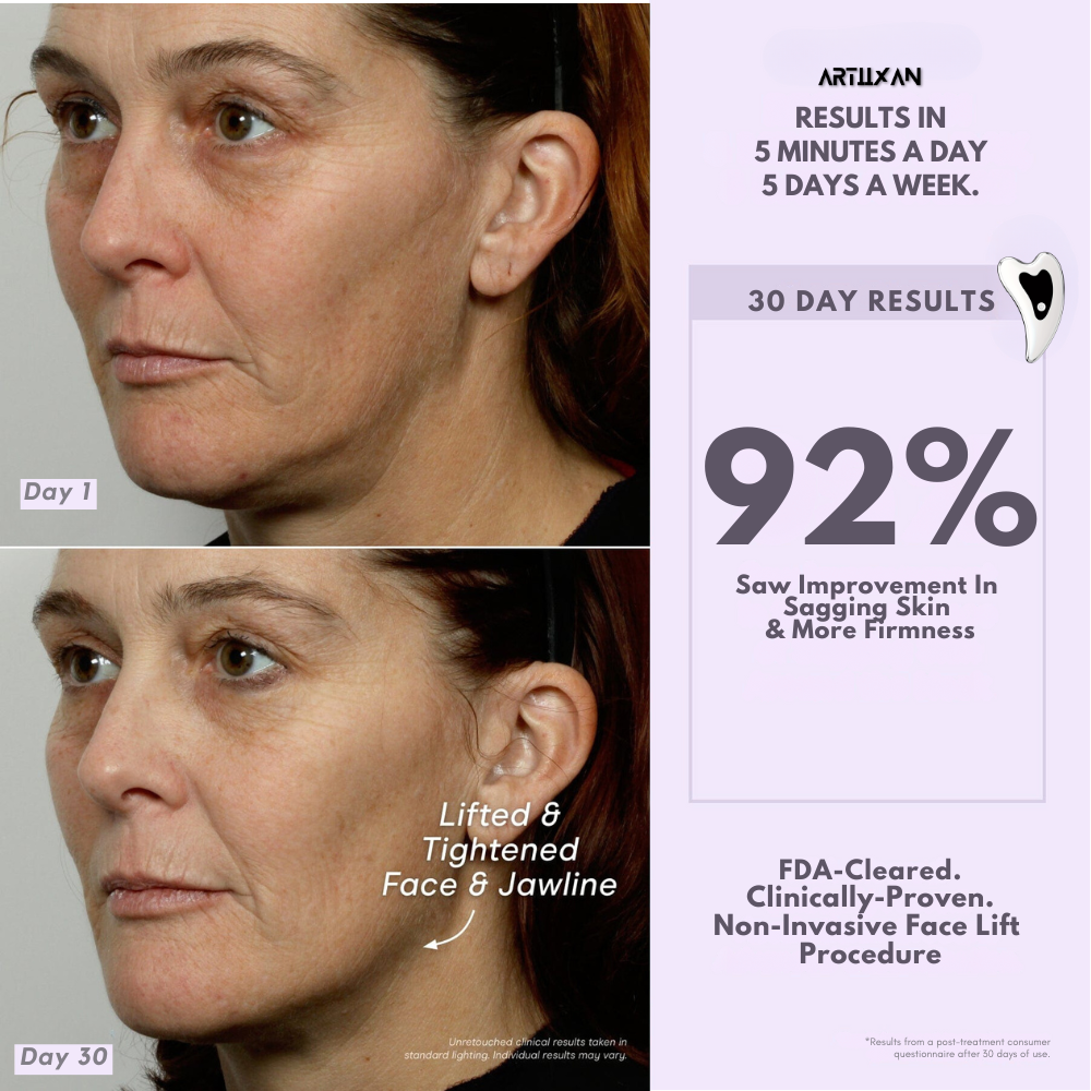 microcurrent device artiixan vibralift face lift at home Facelift alternative artiixan vibralift at home professional non invasive face lift microcurrent device face lift guasha face lift